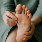Understanding Blisters on the Bottom of Your Foot