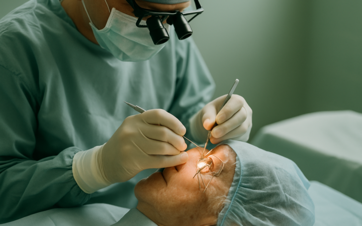 Understanding Cataract Removal: What You Need to Know