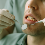 Understanding periodontal disease: A guide to prevention and care