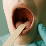 Understanding Bumps on the Back of Your Throat
